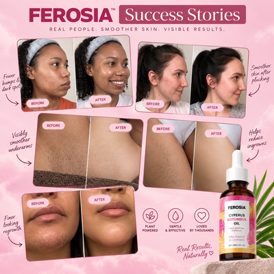 Ferosia™ Cyperus Rotundus Oil